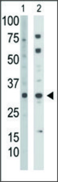 Anti-TK2 (C-term) antibody produced in rabbit IgG fraction of antiserum, buffered aqueous solution