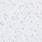 Anti-FAM161A antibody produced in rabbit Prestige Antibodies® Powered by Atlas Antibodies, affinity isolated antibody, buffered aqueous glycerol solution