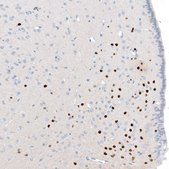 Monoclonal Anti-OTP antibody produced in mouse Prestige Antibodies® Powered by Atlas Antibodies, clone CL11222, purified immunoglobulin, buffered aqueous glycerol solution