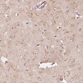 Anti-FMNL2 antibody produced in rabbit Prestige Antibodies® Powered by Atlas Antibodies, affinity isolated antibody, buffered aqueous glycerol solution