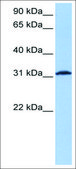Anti-ATF1 (AB2) antibody produced in rabbit affinity isolated antibody