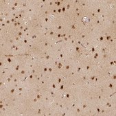 Anti-ZMAT3 Prestige Antibodies® Powered by Atlas Antibodies, affinity isolated antibody