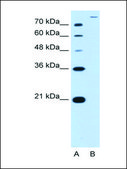 Anti-SLC26A5 antibody produced in rabbit IgG fraction of antiserum