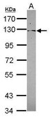 Anti-PSD4 antibody produced in rabbit affinity isolated antibody, buffered aqueous solution