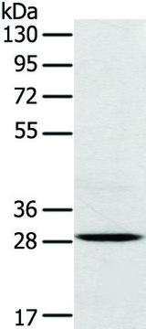 抗TREM2 affinity isolated antibody