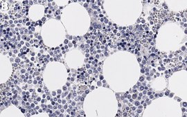 Anti-p70S6 Kinase Antibody, clone 1E13 ZooMAb® Rabbit Monoclonal recombinant, expressed in HEK 293 cells