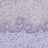 Anti-SLC26A4 antibody produced in rabbit Prestige Antibodies® Powered by Atlas Antibodies, affinity isolated antibody, buffered aqueous glycerol solution