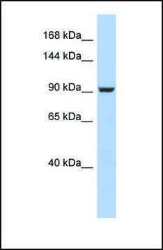 Anti-PMS2 antibody produced in rabbit affinity isolated antibody