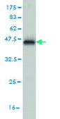 Monoclonal Anti-ETV1 antibody produced in mouse clone 2A8, purified immunoglobulin, buffered aqueous solution