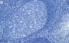 Anti-PCNA Antibody, clone PC10 ZooMAb® Mouse Monoclonal recombinant, expressed in HEK 293 cells