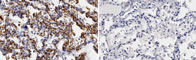 抗-GLUT-1抗体，CT from rabbit, purified by affinity chromatography