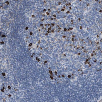 Anti-IFNAR1 antibody produced in rabbit Prestige Antibodies&#174; Powered by Atlas Antibodies, affinity isolated antibody, buffered aqueous glycerol solution