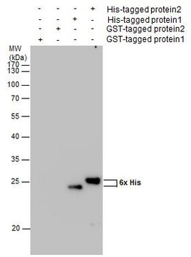 单克隆抗 6X His 标签 小鼠抗 clone GT359, affinity isolated antibody