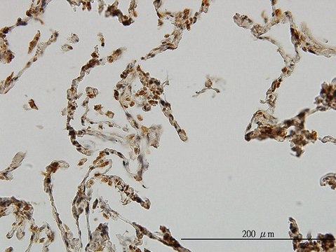 Monoclonal Anti-UBE3A antibody produced in mouse clone 2F6, purified immunoglobulin, buffered aqueous solution