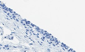 Anti-ErbB2/HER-2 Antibody, clone 1B13 ZooMAb® Rabbit Monoclonal recombinant, expressed in HEK 293 cells