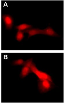 LentiBrite RFP-LC3 Control Mutant Lentiviral Biosensor