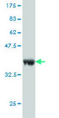 Monoclonal Anti-RAB43 antibody produced in mouse clone 5G4, purified immunoglobulin, buffered aqueous solution