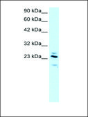 Anti-RGS20 (AB1) antibody produced in rabbit IgG fraction of antiserum