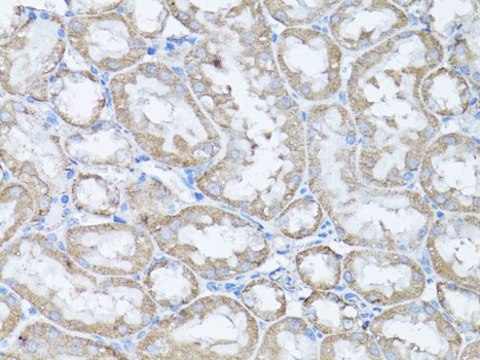 Anti-SNAIL antibody produced in rabbit