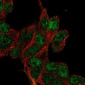 Anti-CLDND2 antibody produced in rabbit Prestige Antibodies® Powered by Atlas Antibodies, affinity isolated antibody, buffered aqueous glycerol solution