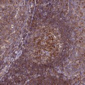 Anti-IRAK3 antibody produced in rabbit Prestige Antibodies® Powered by Atlas Antibodies, affinity isolated antibody, buffered aqueous glycerol solution