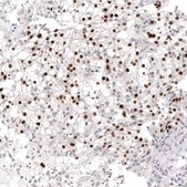 Monoclonal Anti-PAX2 antibody produced in mouse Prestige Antibodies® Powered by Atlas Antibodies, clone CL9469, purified immunoglobulin, buffered aqueous glycerol solution