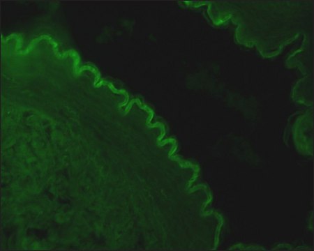 Monoclonal Anti-Cytokeratin Peptide 4 antibody produced in mouse clone 6B10, ascites fluid