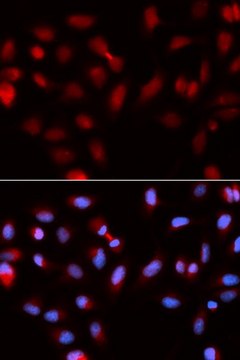 Anti-Survivin antibody produced in rabbit