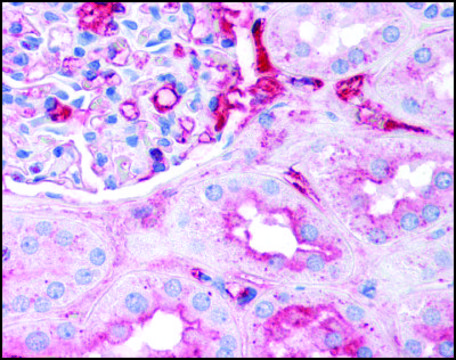 Anti-Fibrinogen (AB2) antibody produced in goat IgG fraction of antiserum, buffered aqueous solution