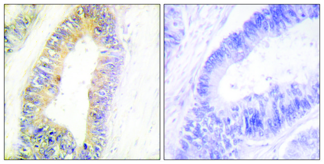 Anti-ZNF638 antibody produced in rabbit affinity isolated antibody