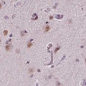 Anti-RCOR3 antibody produced in rabbit Prestige Antibodies® Powered by Atlas Antibodies, affinity isolated antibody