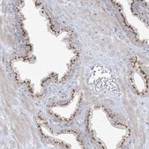 Anti-AFTPH antibody produced in rabbit Prestige Antibodies® Powered by Atlas Antibodies, affinity isolated antibody, buffered aqueous glycerol solution