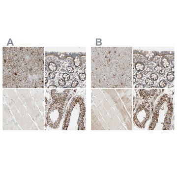 Anti-ARMC10 antibody produced in rabbit Ab2, Prestige Antibodies&#174; Powered by Atlas Antibodies, affinity isolated antibody, buffered aqueous glycerol solution