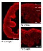 Anti-NPY1R antibody produced in rabbit affinity isolated antibody