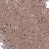 Monoclonal Anti-BRAF antibody produced in mouse Prestige Antibodies® Powered by Atlas Antibodies, clone CL4003, purified immunoglobulin