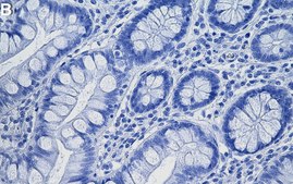 Anti-CD167a/DDR1 Antibody, clone 1D11 ZooMAb® Rabbit Monoclonal recombinant, expressed in HEK 293 cells