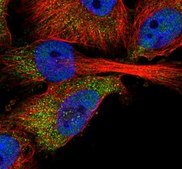 Anti-ABHD2 antibody produced in rabbit Prestige Antibodies® Powered by Atlas Antibodies, affinity isolated antibody, buffered aqueous glycerol solution