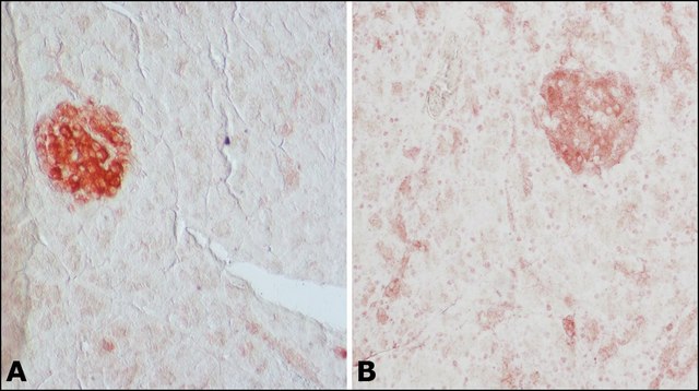 Anti-Glutamic Acid Decarboxylase 65 (5-22) antibody produced in rabbit IgG fraction of antiserum, buffered aqueous solution