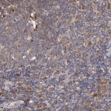 抗-NFKBIE 兔抗 Ab1, Prestige Antibodies&#174; Powered by Atlas Antibodies, affinity isolated antibody, buffered aqueous glycerol solution