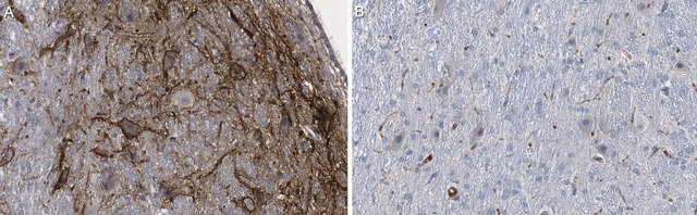 Anti-Aggrecan Core Protein Antibody, clone Cat-315