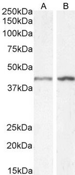 抗-平滑肌 &#945;-肌动蛋白 山羊抗 affinity isolated antibody, buffered aqueous solution