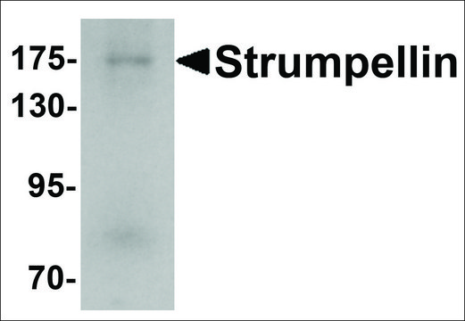 Anti-KIAA0196 antibody produced in rabbit affinity isolated antibody