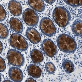 抗-MUC5B 兔抗 Prestige Antibodies&#174; Powered by Atlas Antibodies, affinity isolated antibody, buffered aqueous glycerol solution