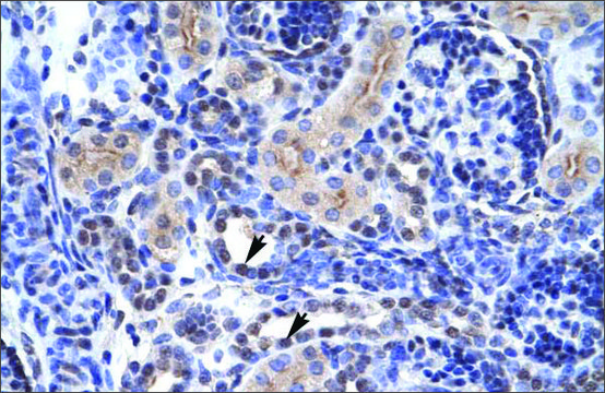 Anti-TAF1 antibody produced in rabbit affinity isolated antibody