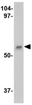 Anti-LGI4 Antibody from rabbit, purified by affinity chromatography