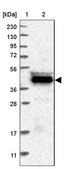 Anti-CARNMT1 antibody produced in rabbit Prestige Antibodies® Powered by Atlas Antibodies, affinity isolated antibody, buffered aqueous glycerol solution