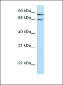 Anti-PPP1R10 antibody produced in rabbit affinity isolated antibody