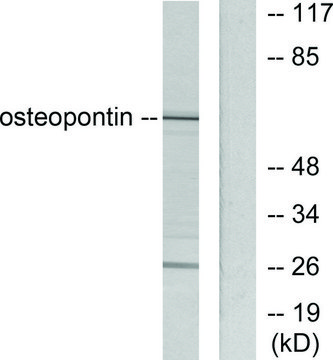 Anti-Osteopontin, C-Terminal antibody produced in rabbit affinity isolated antibody