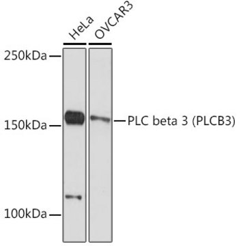 Anti-PLC beta 3 (PLCB3) Antibody, clone 4C0Z7, Rabbit Monoclonal