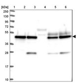 Anti-SNX15 antibody produced in rabbit Prestige Antibodies® Powered by Atlas Antibodies, affinity isolated antibody, buffered aqueous glycerol solution
